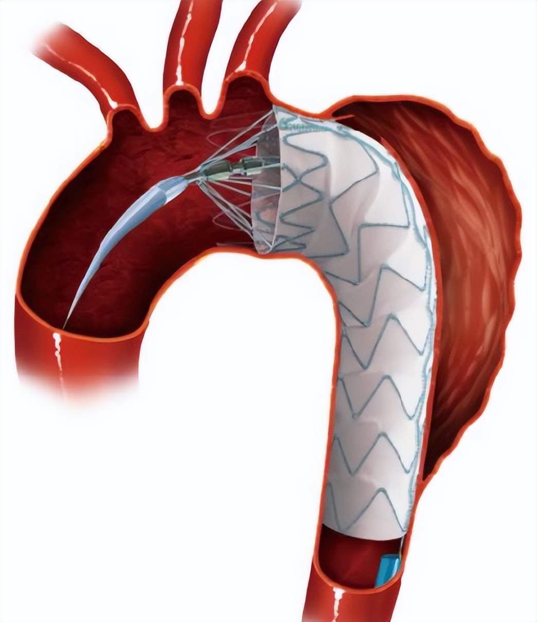 get - 2024-11-07t143743.375